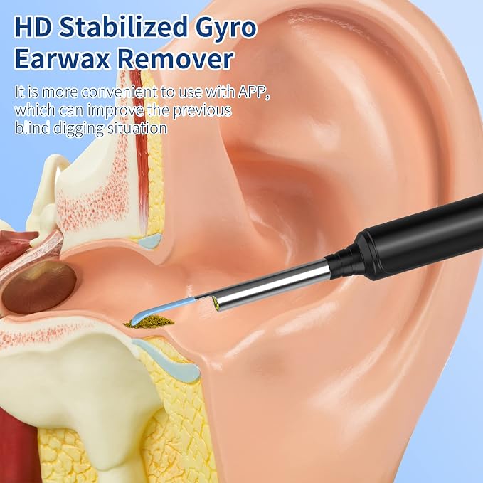 Ear Wax Removal Kit Ear Camera 1296P High-Definition TR7807