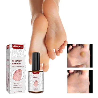 Feet Corn Removal Serum 30ml ( Pack Of 1 ) DS104465