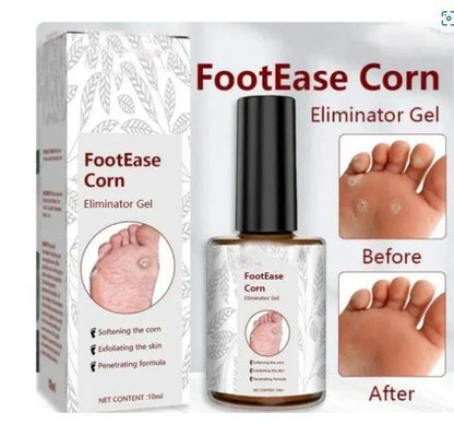 Feet Corn Removal Serum 30ml ( Pack Of 1 ) DS104465